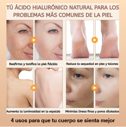 Kit natural de ácido hialurónico